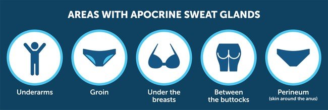 Ιδρωταδενίτιδα Περιοχές Εμφάνισης