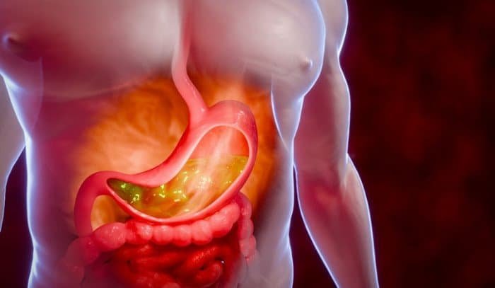 Γαστροοισοφαγική παλινδρόμηση και διατροφή